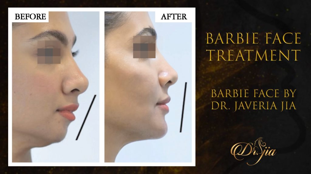 Magic of the Barbie Face Treatment 
