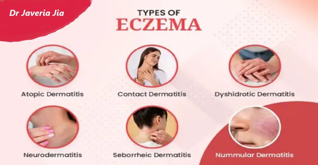 eczema types causes and Effective treatment - skin treatment in dubai