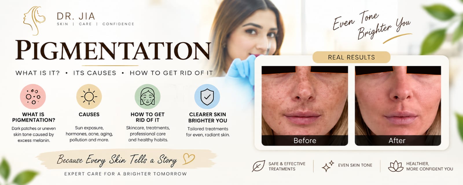 Pigmentation: What Is It, Its Causes, and How to Get Rid of It?